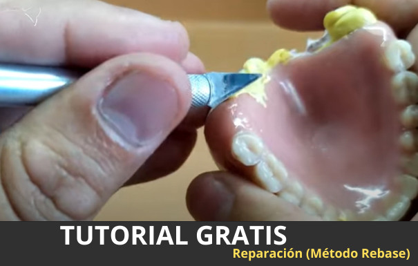 Restaurar y hacer rebase  a prótesis dental  total – Curso